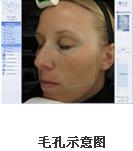 VISIA面部圖像分析儀產品介紹 VISIA面部圖像分析儀產品介紹