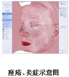 VISIA沿DxaƷB